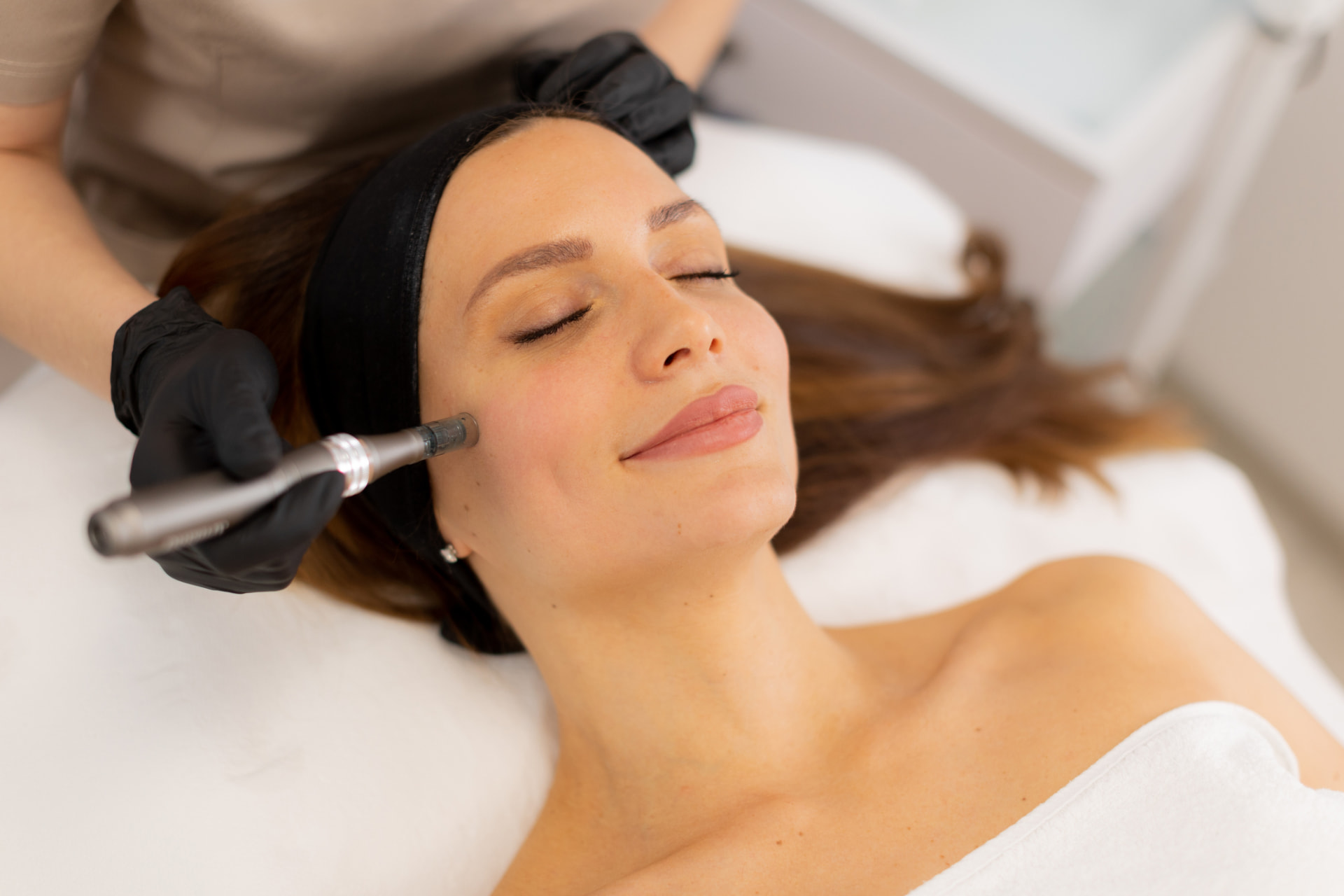 Microneedling Behandlung bei BAlm Aesthetics in Voerde